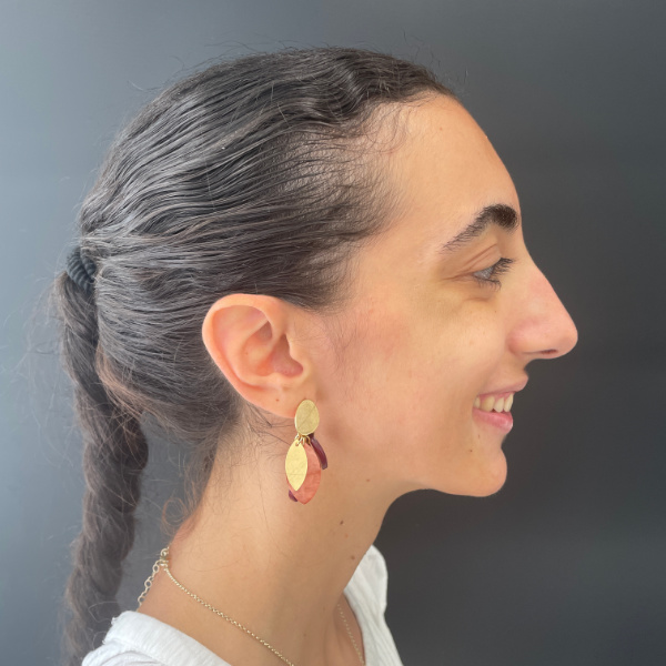 Simulación digital 3D del avance dental y corrección de mordida con tecnología Invisalign en clínica dental dr. Lorente Valencia
